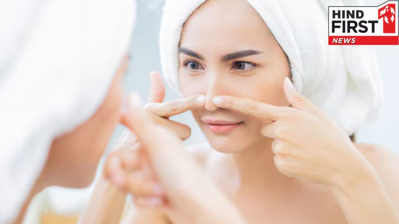 गर्मी में ब्लैकहेड्स से हैं परेशान तो अपनाएं ये घरेलू उपाय, मिलेगा आराम