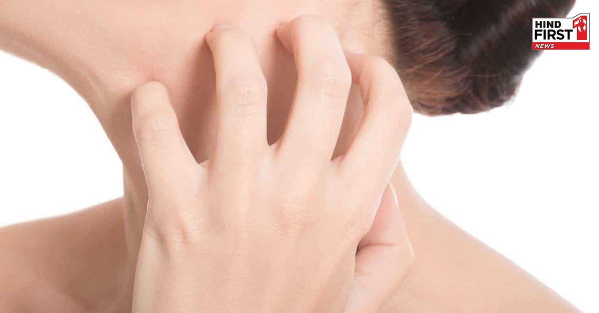 अगर गर्मी के कारण हो गई है स्किन एलर्जी, तो इन तरीकों से पा सकतें हैं छुटकारा अगर गर्मी के कारण हो गई है स्किन एलर्जी, तो इन तरीकों से पा सकतें हैं छुटकारा