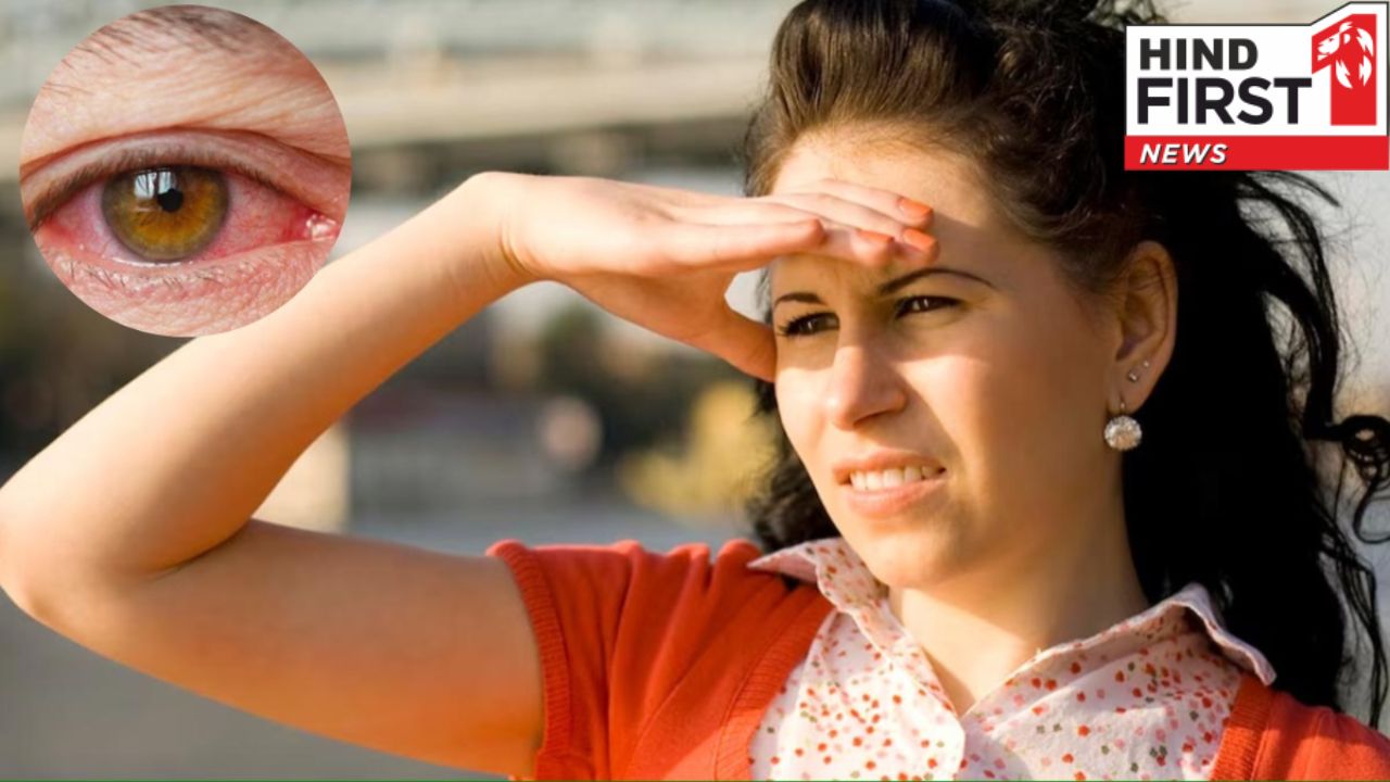 हीट वेव से आंखें हो सकती हैं ख़राब, जानिए कैसे करें बचाव हीट वेव से आंखें हो सकती हैं ख़राब, जानिए कैसे करें बचाव