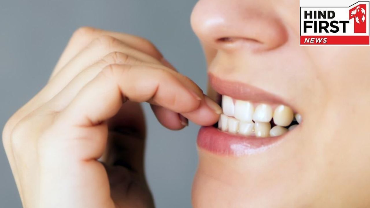 Nail Biting Habit: दांतों से नाखून कुतरने की आदत कई बिमारियों की है जड़ , आज ही छोड़ दें