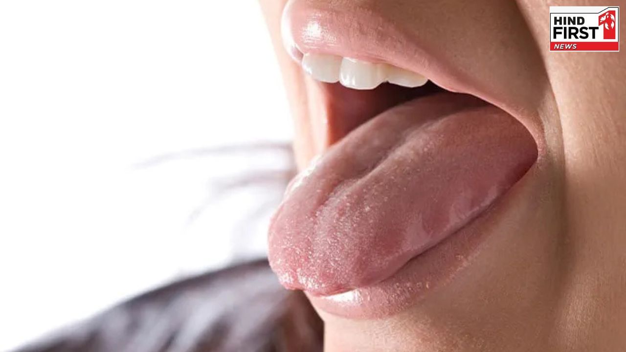 Health Tips: आपकी जीभ बताती है आपके सेहत के हालात, ऐसे पहचानें परेशानी