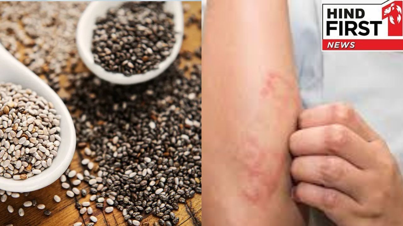 Chia Seed Side Effects: ओह ! रोजाना चिया सीड खाना आपको कर सकता है  बहुत बीमार