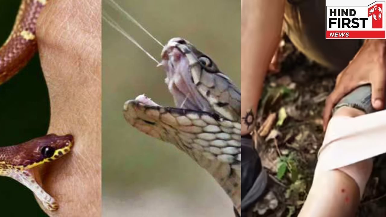 Health : सांप काटने के तुरंत बाद करना चाहिए ये फर्स्टऐड, बच सकती है जान