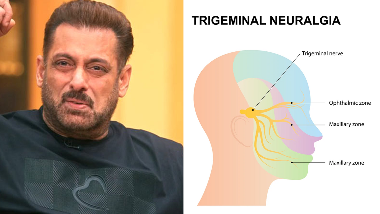 Trigeminal Neuralgia: सलमान खान को हुई थी यह दर्दनाक बीमारी, जानें इसके कारण, लक्षण और उपचार Trigeminal Neuralgia: सलमान खान को हुई थी यह दर्दनाक बीमारी, जानें इसके कारण, लक्षण और उपचार