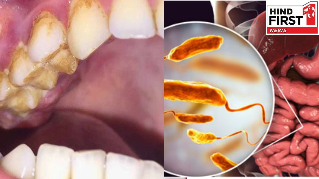 Health Alert : आपकी ख़राब ओरल हेल्थ कैंसर का बन सकता है कारण, हो जाएं अलर्ट